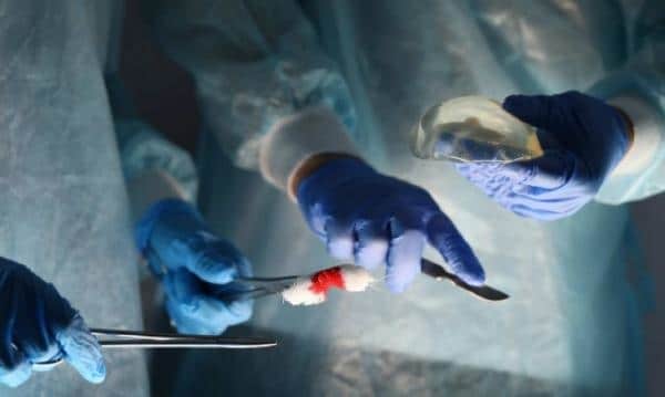 cirurgia para inserção de prótese de silicone