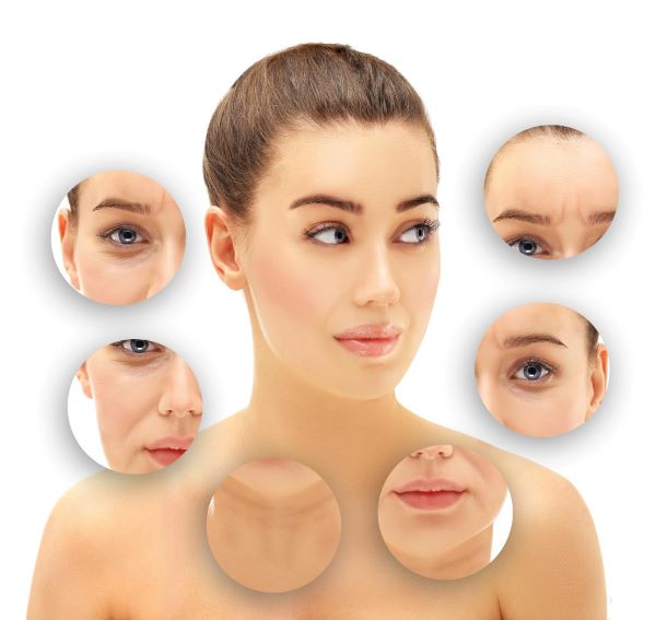 Áreas da face de uma paciente, as quais serão tratadas com ácido hialurônico para rejuvenescimento.