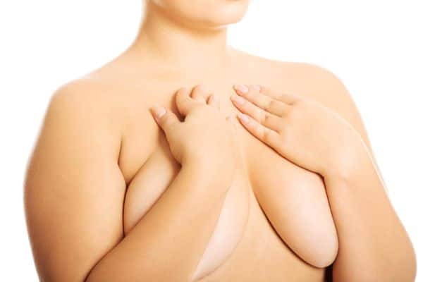 Mulher cobre os seios flácidos com as mãos, analisando futura mamoplastia sem implante de silicones.
