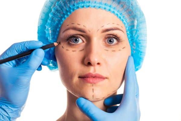 Preparação para cirurgia facial. Close do rosto de uma mulher sendo marcado para o procedimento de harmonização facial pelas mãos de um médico que usa luvas azuis.