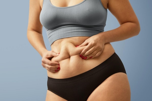 Mulher com sobrepeso e gordura localizada no abdômen.