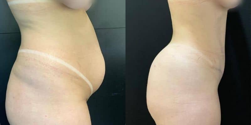 Abdomen-2